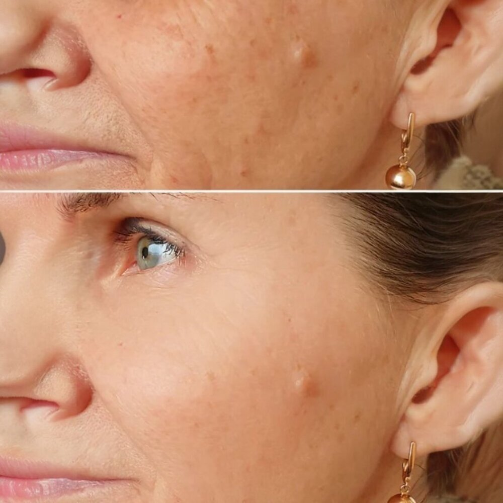 Hydrating Red Lava Foam Facial Cleanser with Collagen & Stem Cell Technology NEW - Picture 2 of 3